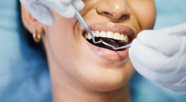 Best Urgent Dental Care for Toothaches in Morristown, NJ